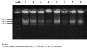 Plasmid-profile-Vibrio-Cholera